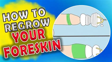 foreskin underwear|How to Heal Foreskin Cuts .